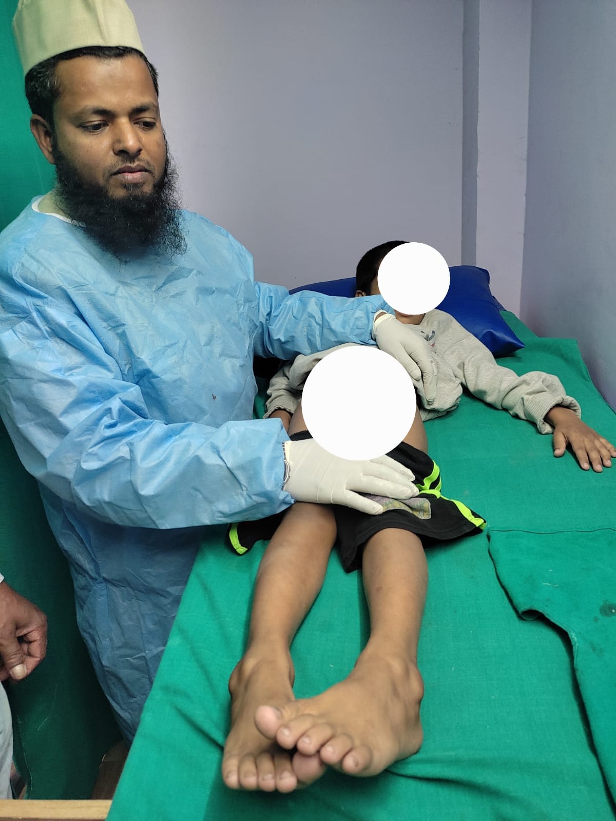 Dr Umar Circumcised Surgery Khatna Sunnat